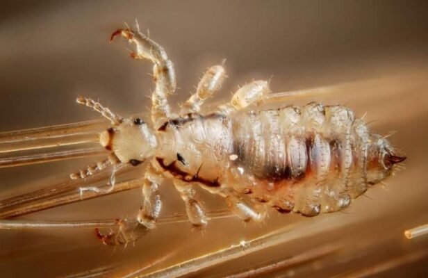 Чи можуть нерви стати причиною появи вошей: міфи та реальність