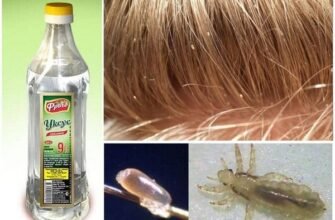 Ефективне використання дустового мила для боротьби з вошами у дітей