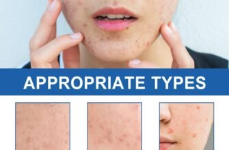 Ефективні гідроколоїдні пластирі: рішення для боротьби з прищами