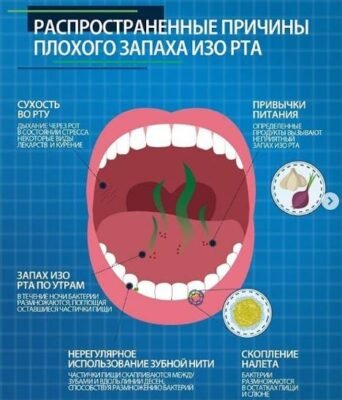 Ефективні ліки від неприємного запаху з рота: огляд та рекомендації