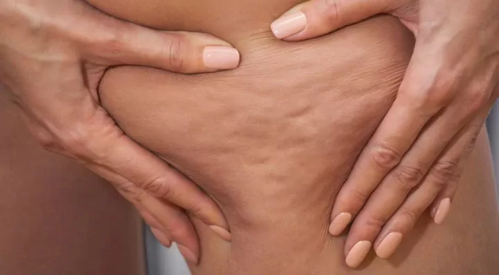 Засоби від целюліту ✔️ Купити антицелюлітні засоби у Києві ...