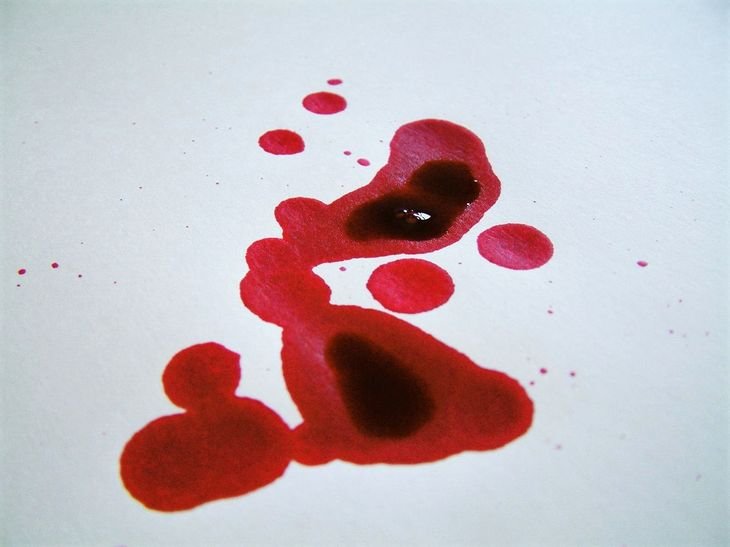 Як відіпрати кров – чим краще за все вивести плями крові