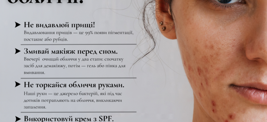 Ефективні засоби для боротьби з прищами на обличчі: огляд і поради