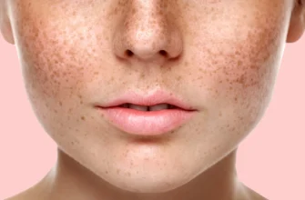 Ефективний крем для обличчя: як позбутися пігментних плям назавжди