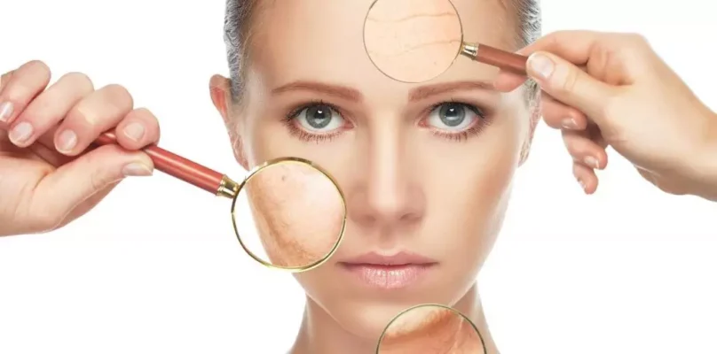 Ефективний крем від іхтіозу: як обрати найкращий засіб для шкіри