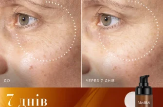 Ефективний крем від зморшок після 40: огляд найкращих засобів