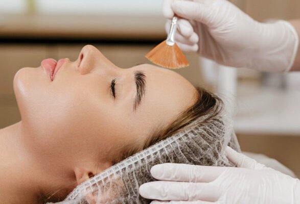 Ефективний пілінг для лікування постакне: як обрати найкращий метод