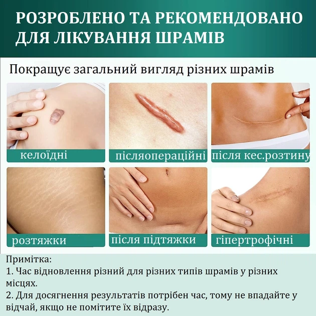 Силіконовий пластир від шрамів та рубців AirroYE 4х150 від ...