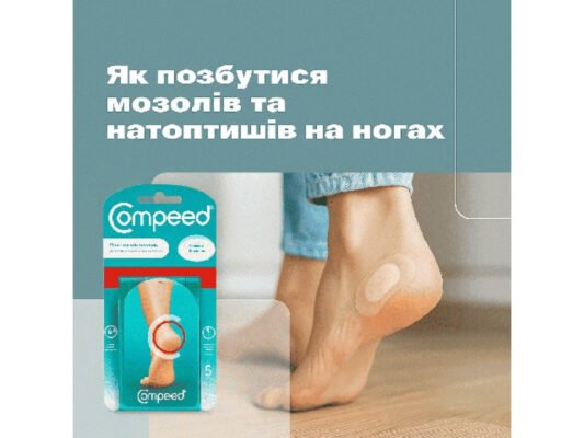 Ефективний засіб від мозолів: Як швидко позбутися болю і дискомфорту