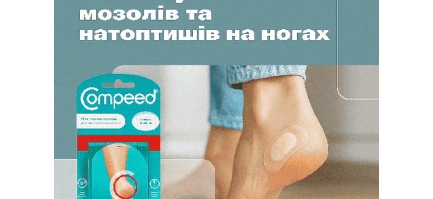 Ефективний засіб від мозолів: Як швидко позбутися болю і дискомфорту