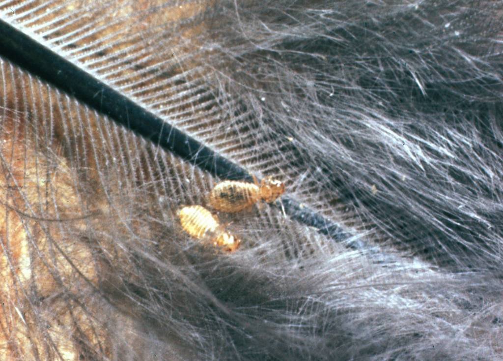 Біорезонансна терапія: новий підхід до лікування паразитарних інфекцій