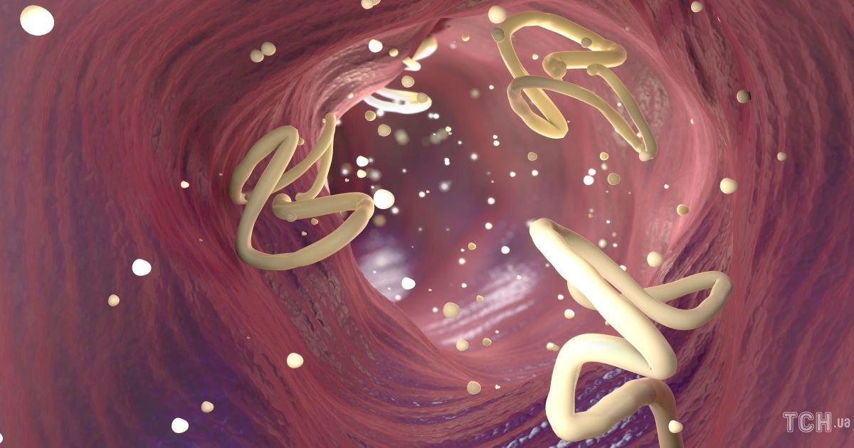 Як боротися з глистами: види паразитів, симптоми і шляхи зараження ...