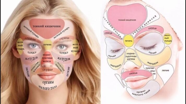 Основні причини появи прищів на обличчі: від чого вони виникають?