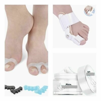 Перевірені рецепти для ефективного лікування кісточок на нозі