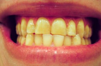 Причини, чому зуби жовтіють: основні фактори та поради для ясності