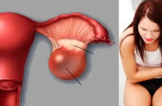 Причини перекруту яєчка: від чого виникає це небезпечне захворювання?