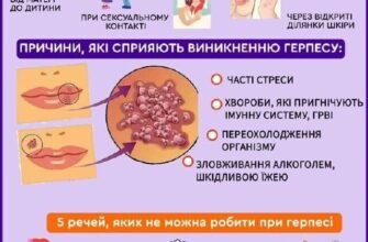 Причини появи герпесу на губах: основні фактори та профілактика