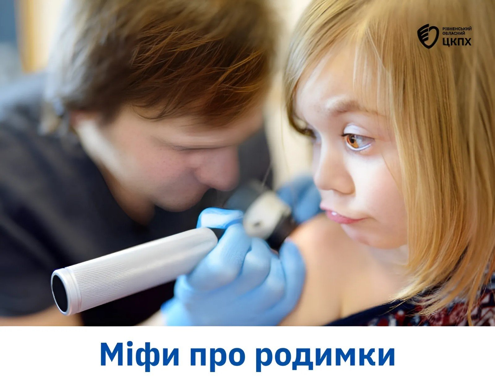 Чому з'являються родимки- 7 днів