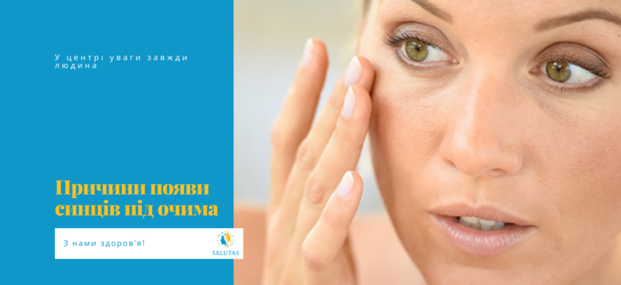 Причини появи синяків під очима: основні фактори та рішення