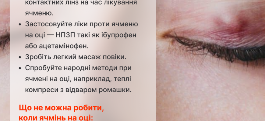 Причини появи ячменю на оці: основні фактори та профілактика