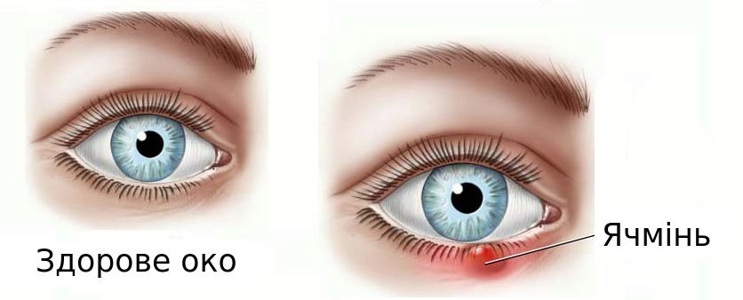 Лікування очних захворювань в Києві, лікування захворювань очей в ...