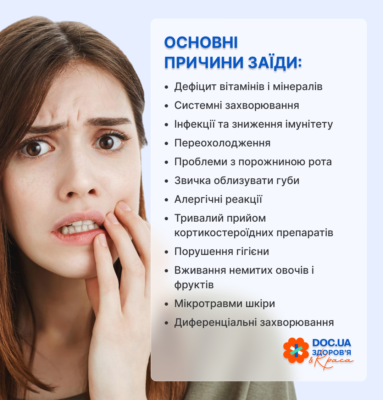 Причини появи заїд на губах: основні фактори та запобігання