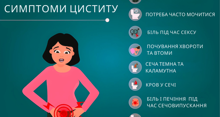 Причини циститу у жінок: основні фактори та як їх уникнути