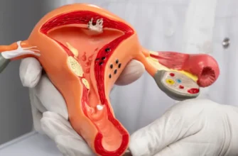 Причини утворення кісти яєчника: основні фактори та ризики