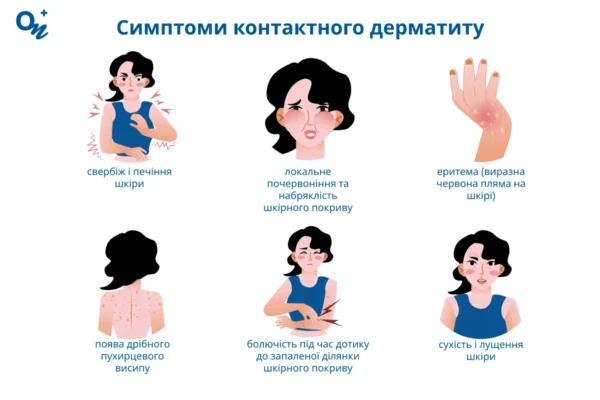 Причини виникнення дерматиту: основні фактори та способи уникнення