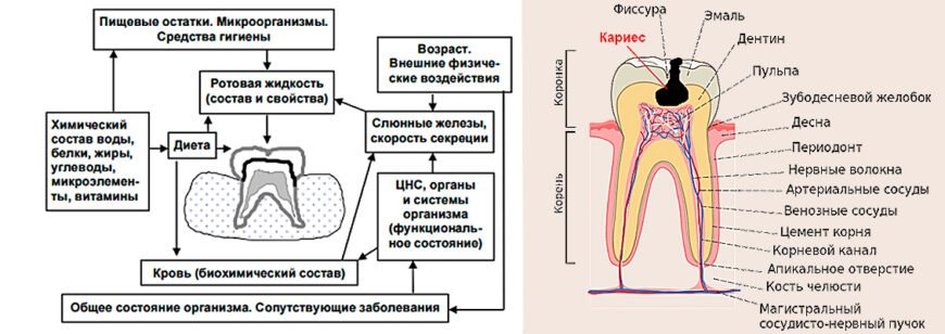 Причини виникнення карієсу: основні фактори та профілактика