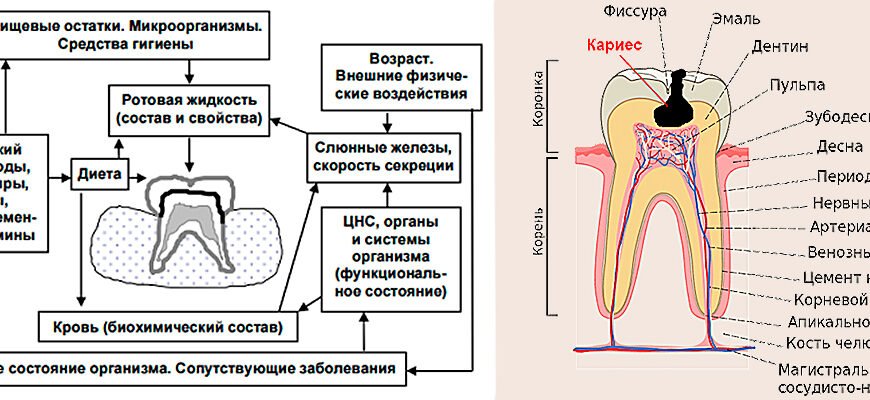 Причини виникнення карієсу: основні фактори та профілактика