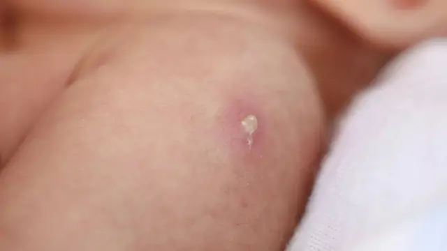 Вакцинація. Запитання та відповіді. - ГО “Батьки за вакцинацію”