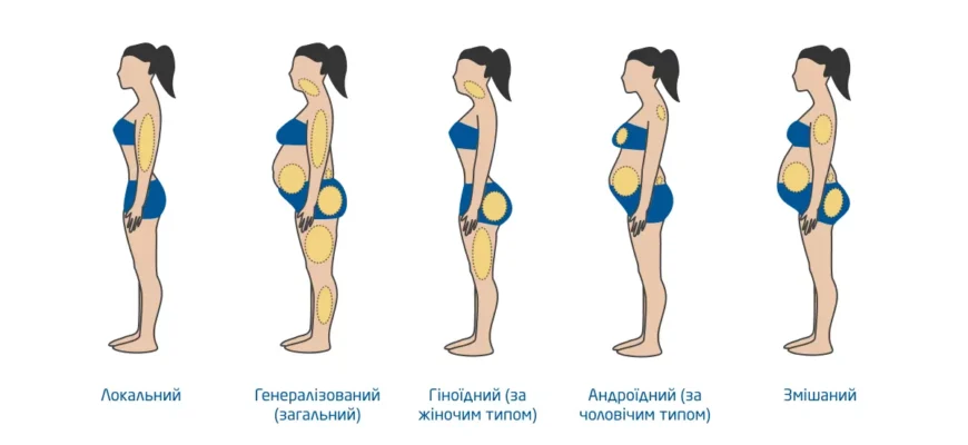 Скільки часу зберігається ефект від ліполітиків: повний огляд