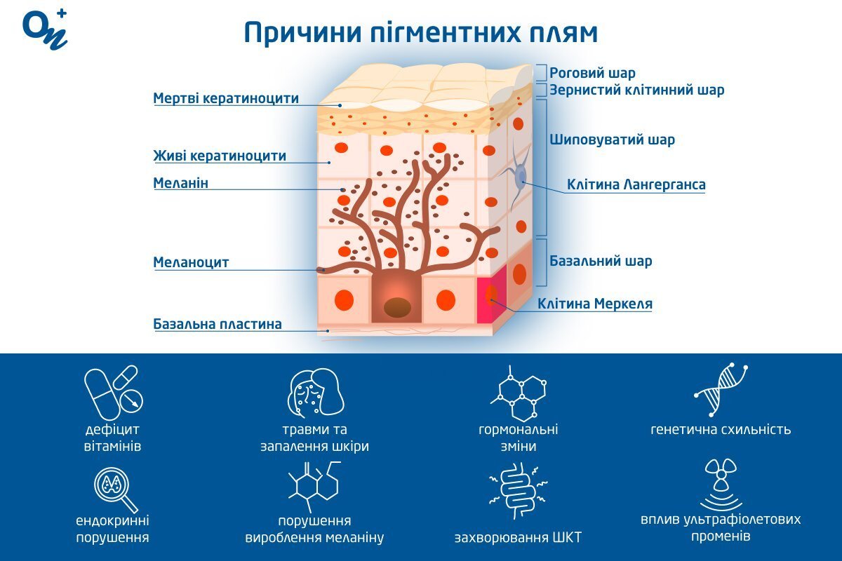 Як прибрати пігментні плями на обличчі та тілі — блог медичного ...