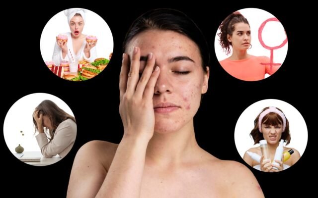 Відкрийте таємниці: ефективні методи боротьби з прищами на шкірі