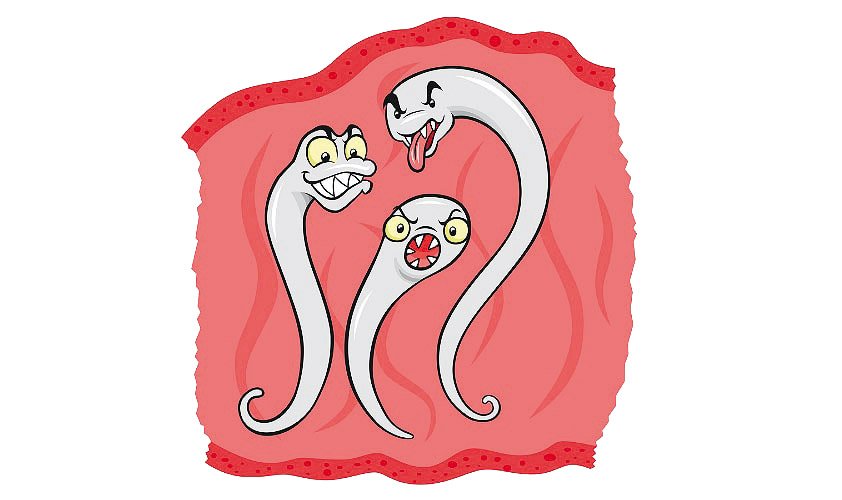 Цистит: симптоми, лікування у жінок і чоловіків