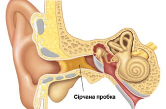 Як безпечно та ефективно почистити вуха від сірки вдома