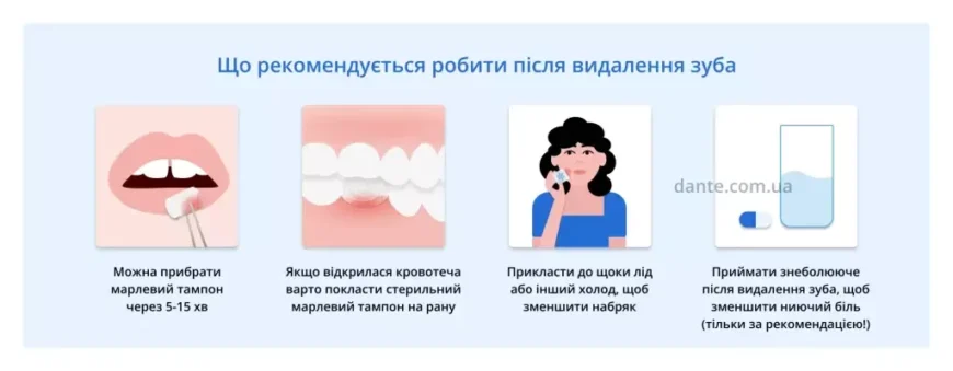 Як швидко та безпечно відновитися після анестезії зуба? Поради фахівців