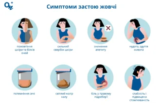 Як жовчний міхур впливає на появу висипів на шкірі: Причини і рішення