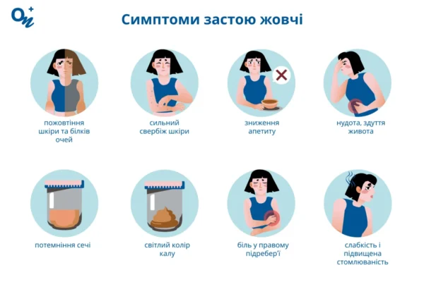 Як жовчний міхур впливає на появу висипів на шкірі: Причини і рішення