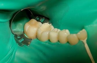 Здоров’я зубів: як забезпечити надійний захист від карієсу і хвороб