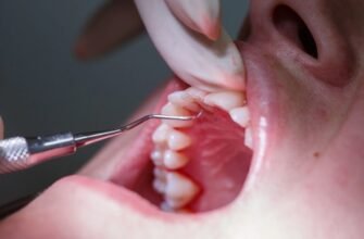 Синус-ліфтинг: чому бракує кістки і чим відкритий метод відрізняється від закритого
